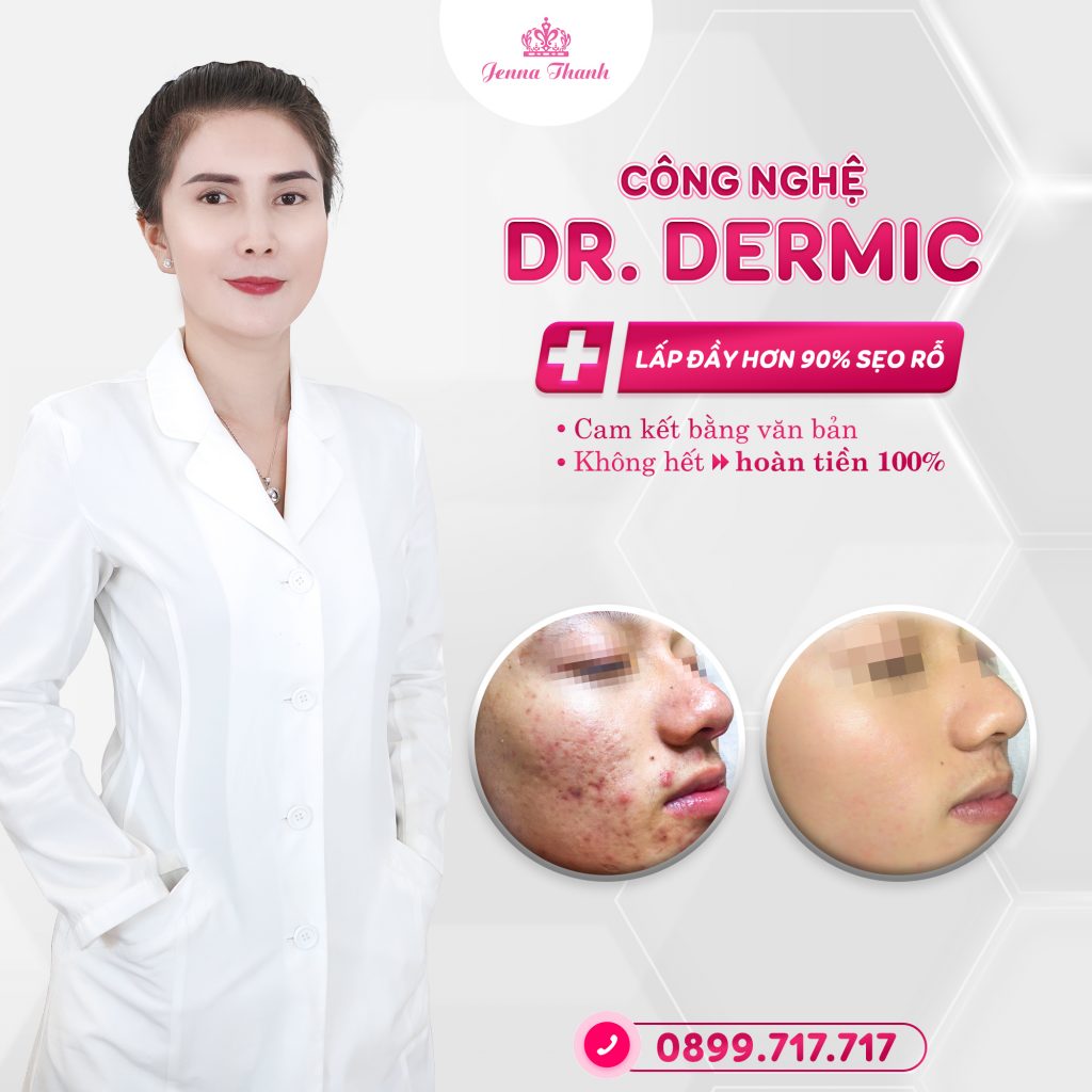 Sử dụng công nghệ Dr. Dermic điều trị thành công nhiều ca bệnh sẹo rỗ