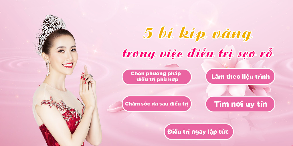 5 bí kíp vàng trong điều trị sẹo rỗ