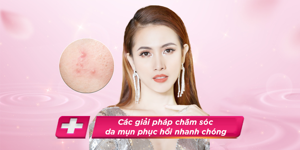 Các giải pháp chăm sóc da mụn phục hồi nhanh chóng