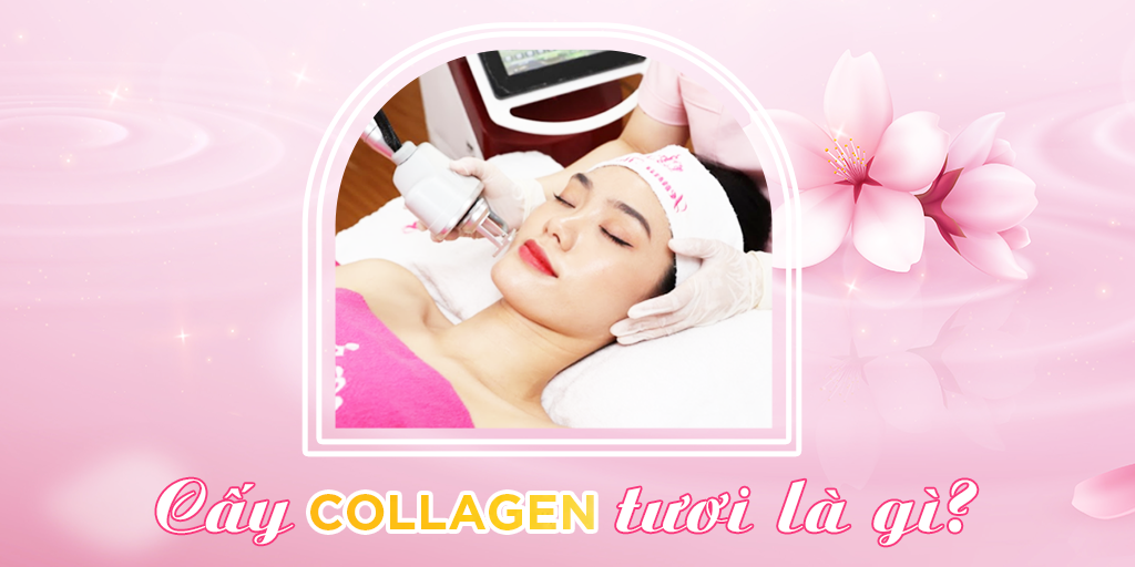 4. So sánh cấy collagen tươi với các phương pháp làm đẹp khác