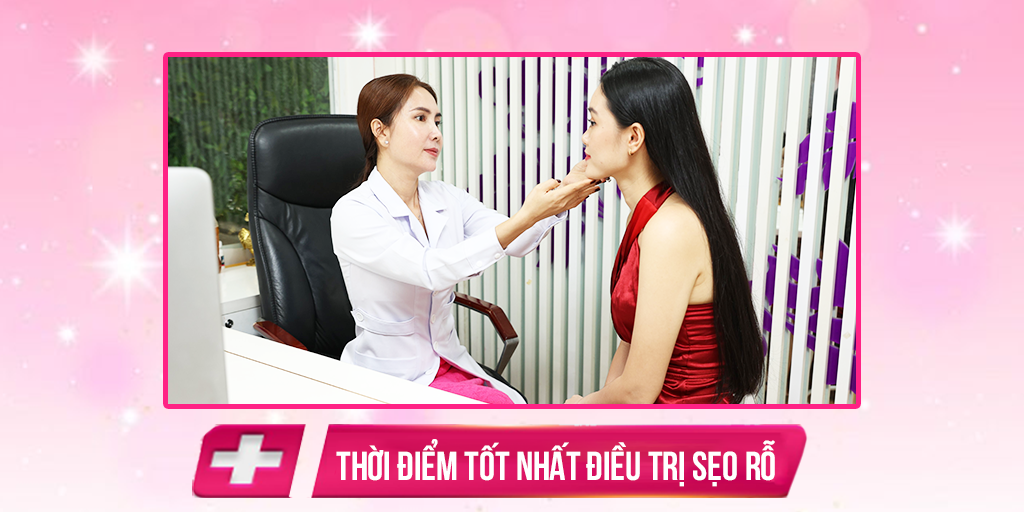 Thời điểm tốt nhất điều trị sẹo rỗ