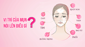 Vị trí mụn nói lên điều gì về sức khỏe