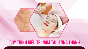 Quy trình điều trị nám tại Jenna Thanh