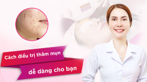 Cách điều trị mụn thâm dễ dàng cho bạn