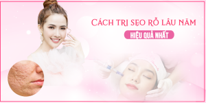 Cách trị sẹo rỗ lâu năm hiệu quả nhất