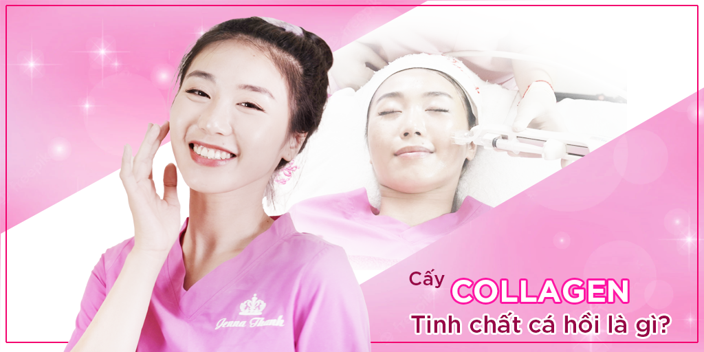 Cấy collagen tinh chất cá hồi là gì