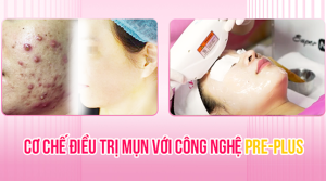 Cơ chế điều trị mụn với công nghệ Pre-Plus