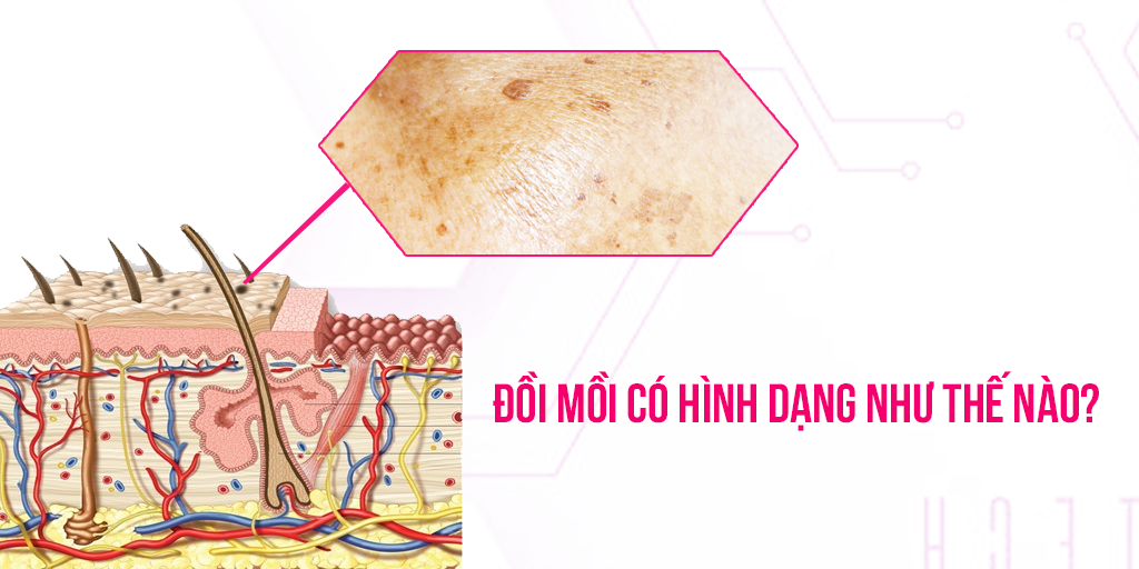 Đồi mồi có hình dạng như thế nào