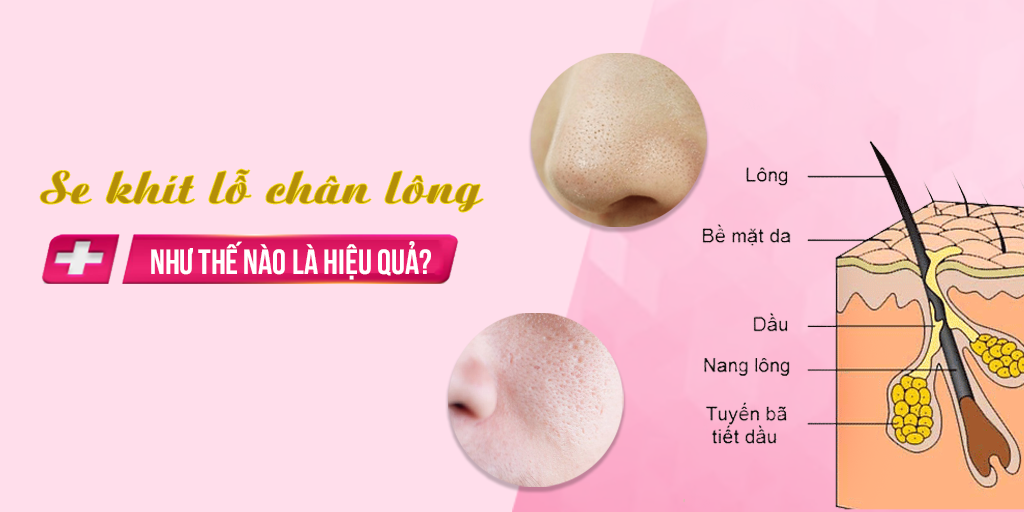 Se khít lỗ chân lông như thế nào là hiệu quả