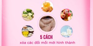 5 cách xóa đồi mồi mới xuất hiện