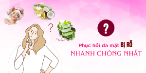 Phục hồi da mặt bị sẹo rỗ nhanh chóng nhất