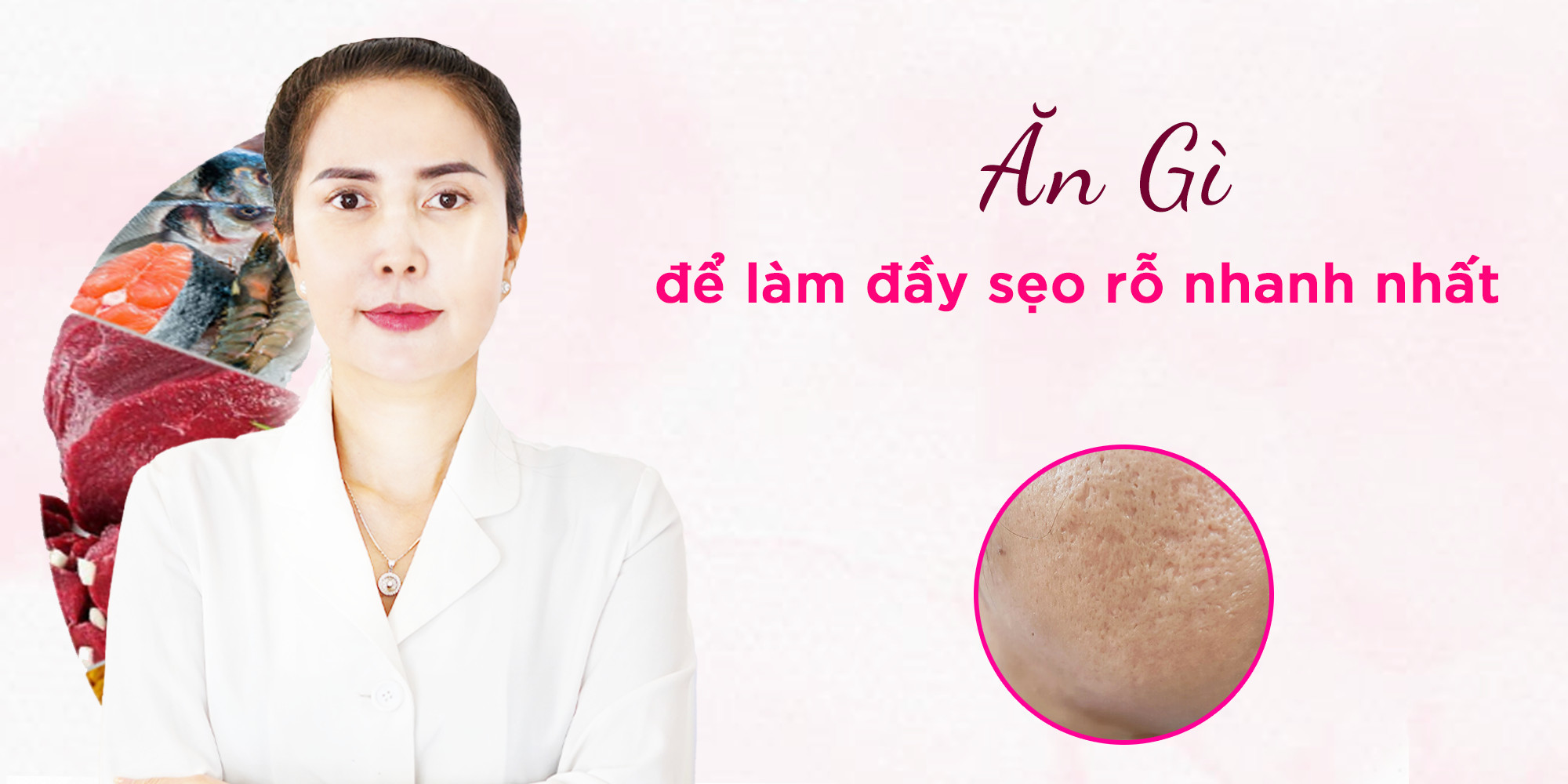 ăn gì để làm đầy sẹo rỗ nhanh nhất