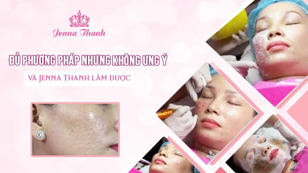 Đủ phương pháp nhưng không như ý và Jenna Thanh làm được