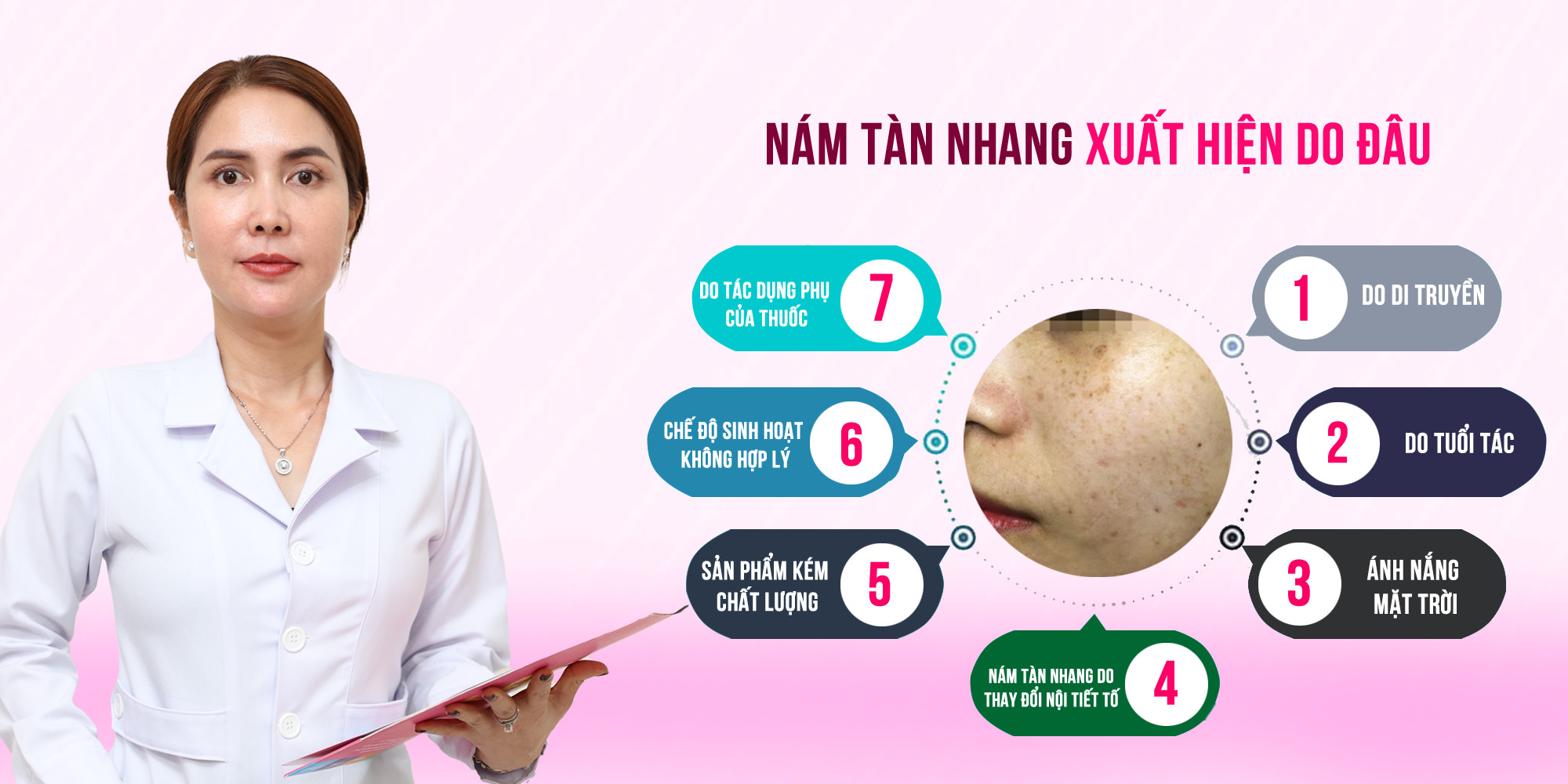 nám tàn nhang xuất hiện do đâu, nguyên nhân gì