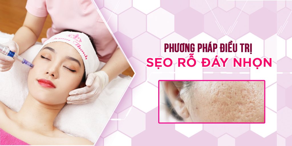 Phương pháp điều trị sẹo rỗ đáy nhọn