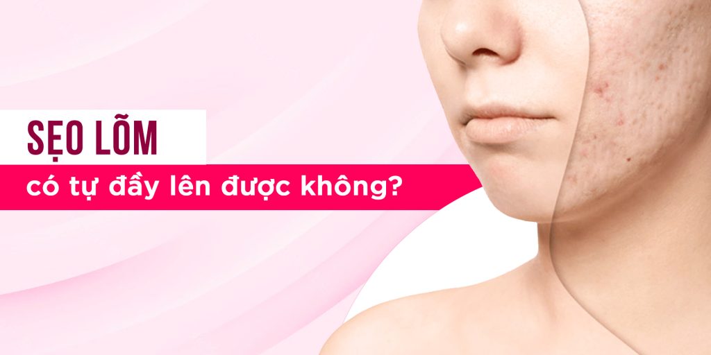 Sẹo lõm có tự đầy lên được không?