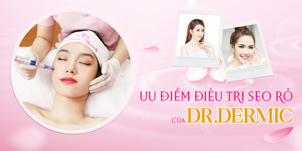 Ưu điểm điều trị sẹo rỗ của Dr. Dermic