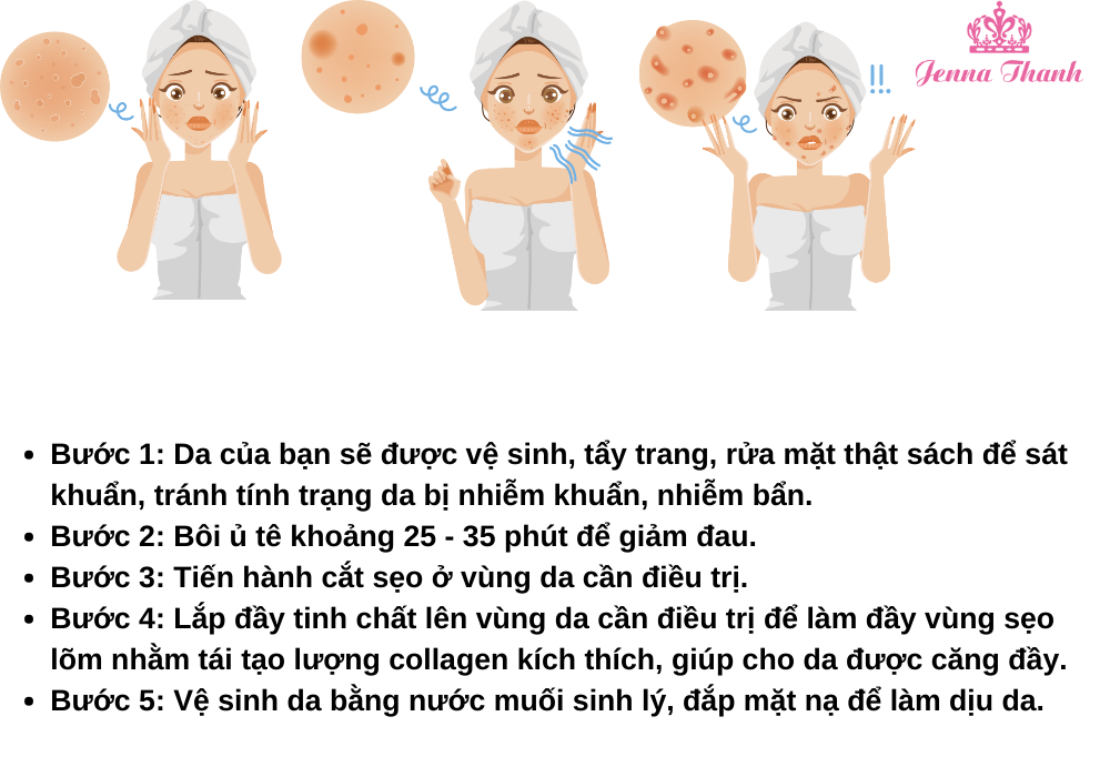 Buoc 1 Da cua ban se duoc ve sinh tay trang rua mat that sach de sat khuan tranh tinh trang da bi nhiem khuan nhiem ban. Buoc 2 Boi u te khoang 25 35 phut de giam dau. Buoc 3 Tien hanh cat s